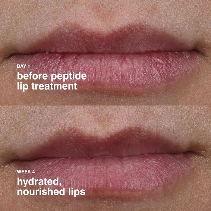 Rhode Peptide Lip Treatment Watermelon Slice